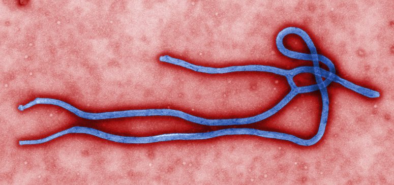 an illustration of the ebola virus