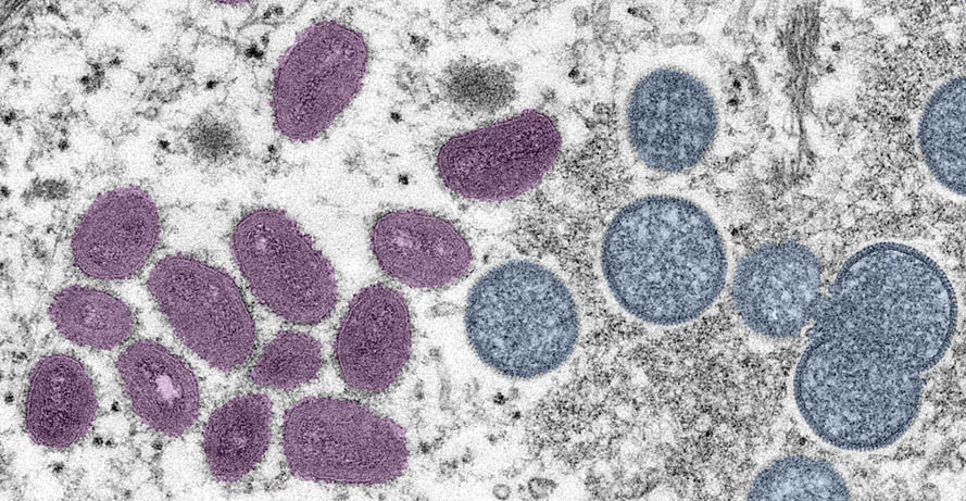 microscopic image of the monkey pox virus