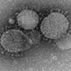 Image of MERS-CoV particles as seen by negative stain electron microscopy.